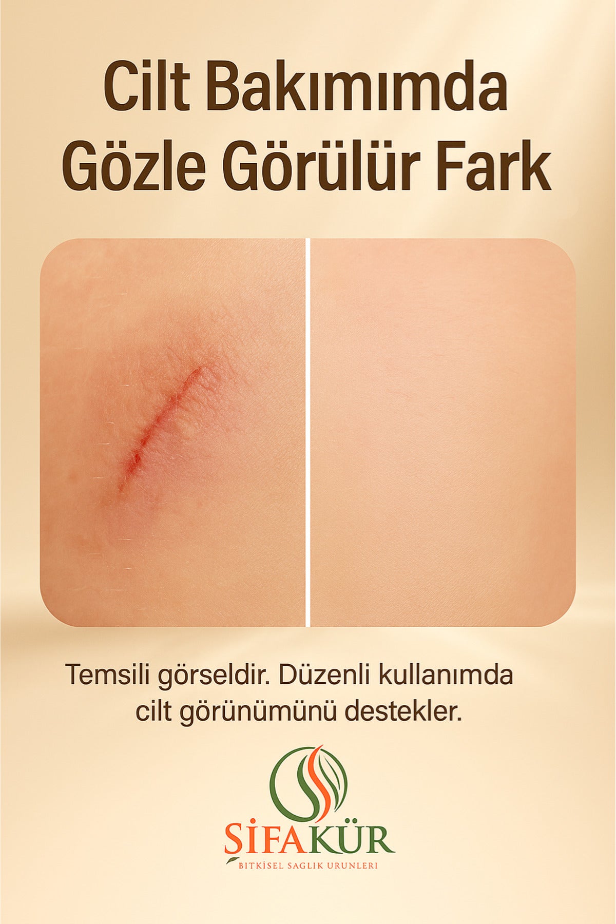 Şifakür Zurafencu Krem Bitkisel İçerikli Yoğun Nemlendirici Hassas Cilt Bakımı 100ml