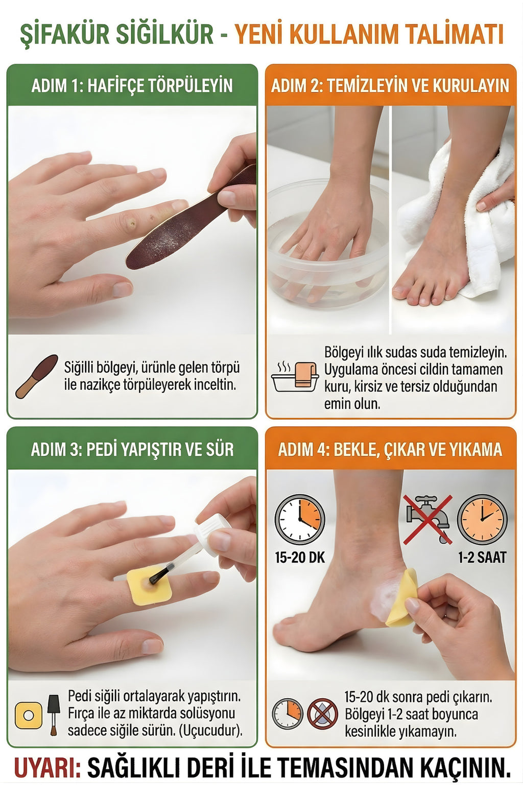 Siğilkür Siğil Giderici Bitkisel Solüsyon 20ml - Törpü ve Koruyucu Pedli Tam Bakım Seti