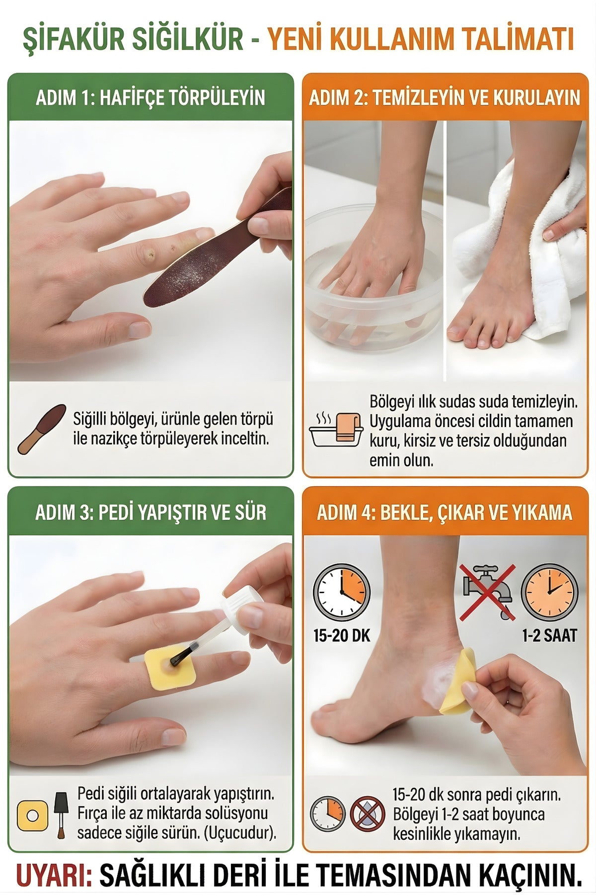 Siğilkür Siğil Giderici Bitkisel Solüsyon 20ml - Törpü ve Koruyucu Pedli Tam Bakım Seti