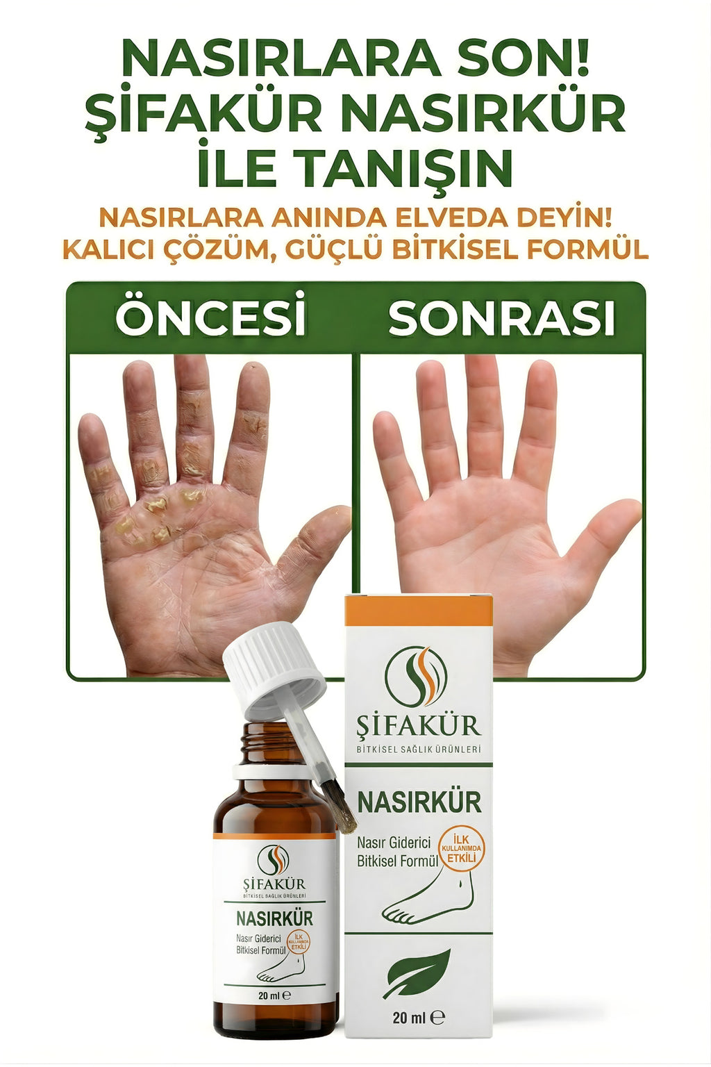 Nasırkür Bitkisel Nasır Sökücü Solüsyon 20ml Törpü ve 8'li Koruyucu Ped - Tam Bakım Seti