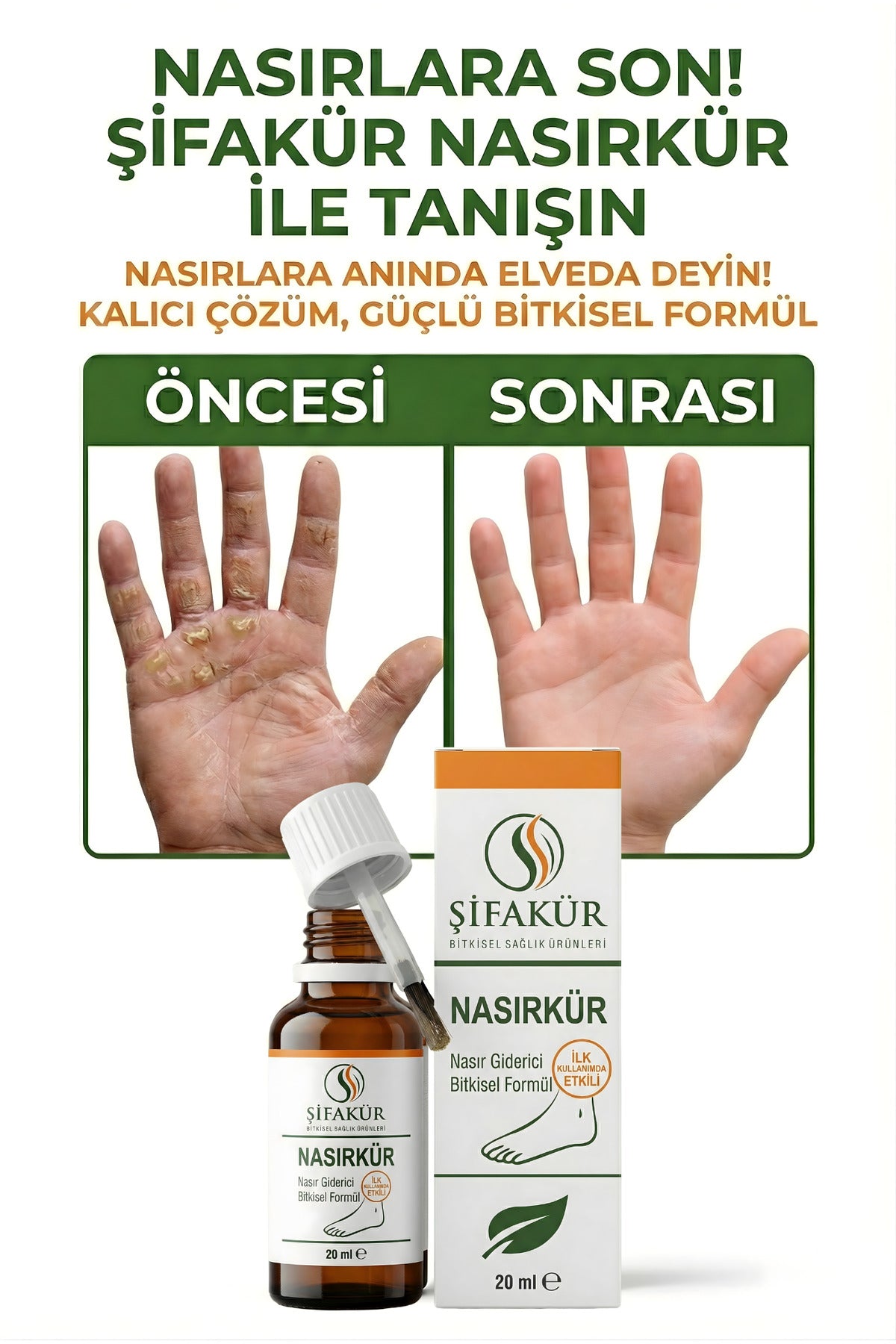 Nasırkür Bitkisel Nasır Sökücü Solüsyon 20ml Törpü ve 8'li Koruyucu Ped - Tam Bakım Seti