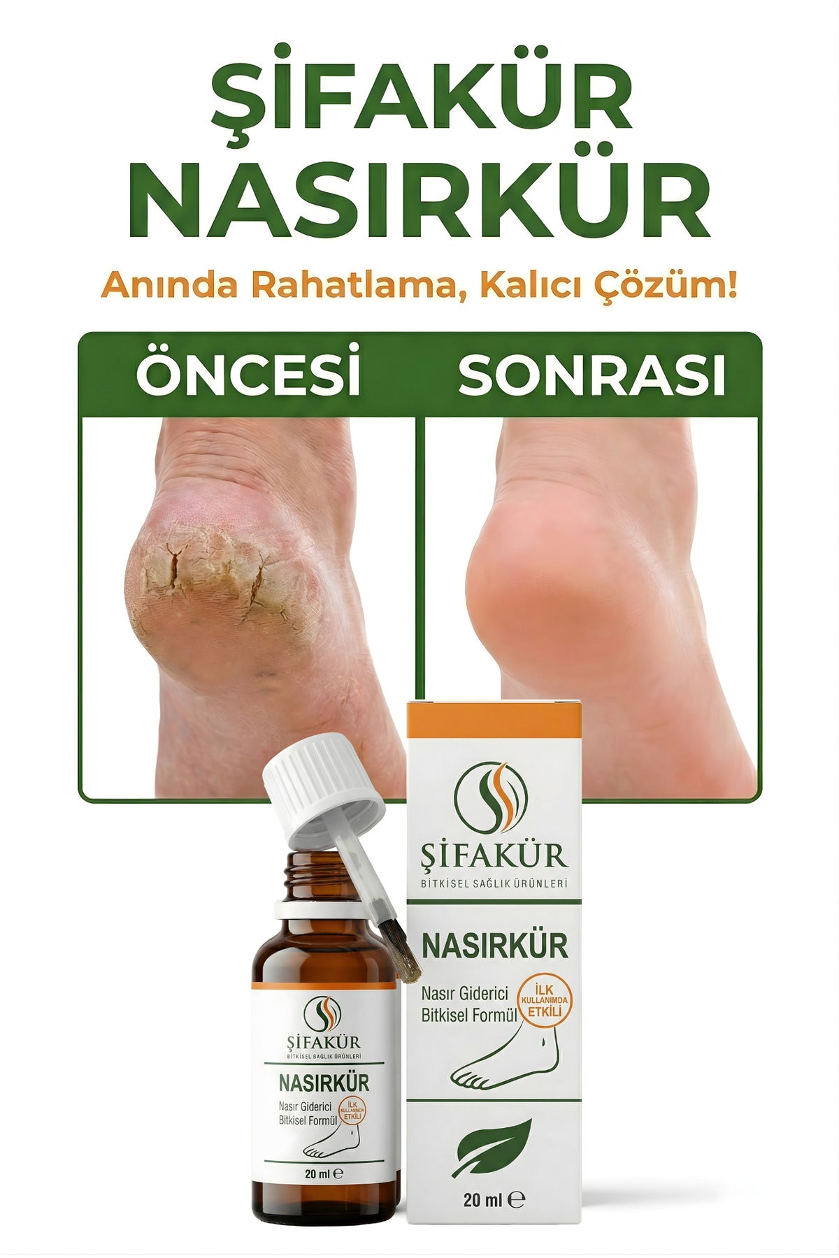 Nasırkür Bitkisel Nasır Sökücü Solüsyon 20ml Törpü ve 8'li Koruyucu Ped - Tam Bakım Seti